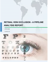 Retinal Vein Occlusion - A Pipeline Analysis Report